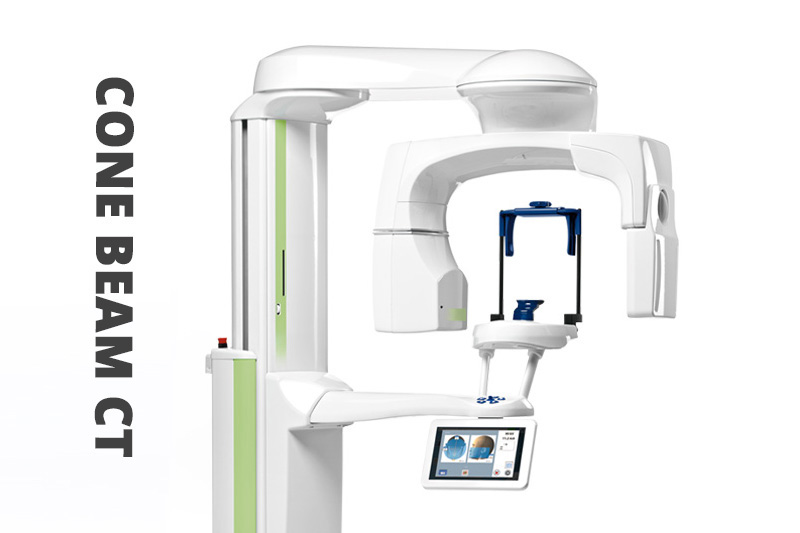 Cone Beam CT Imaging in Sunnyvale