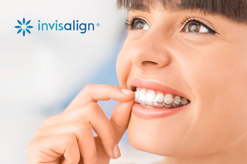 Cosmetic Dentist in Sunnyvale