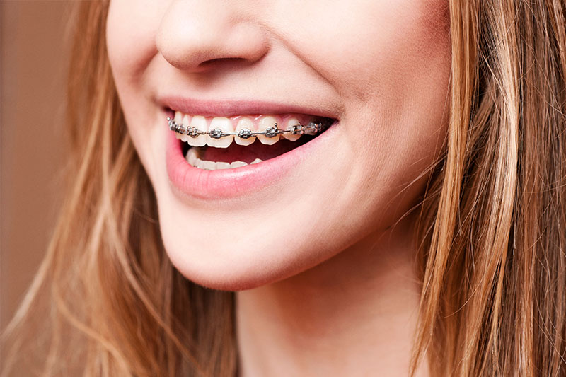 Sunnyvale Orthodontics