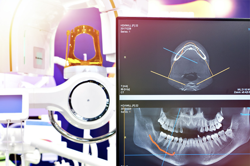 Digital X-Rays in Sunnyvale