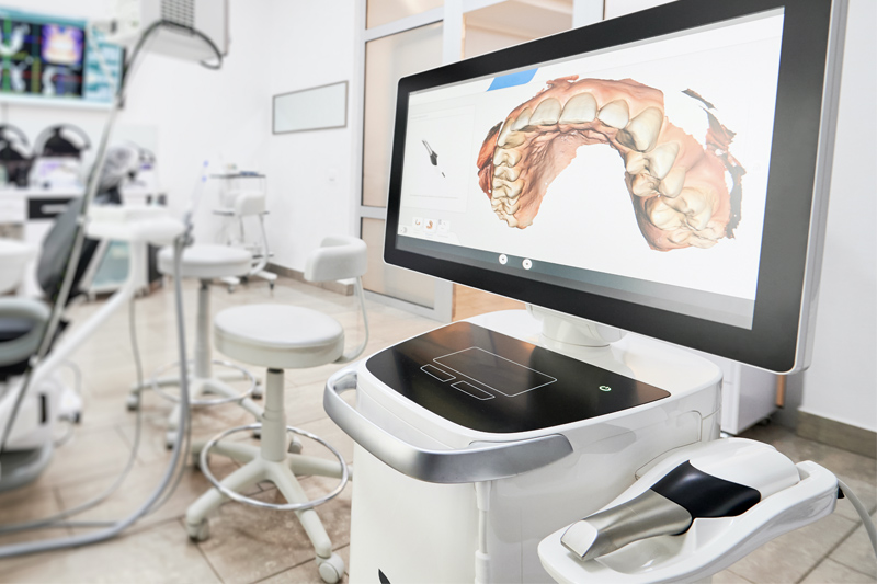 Intra-Oral Scanner in Sunnyvale